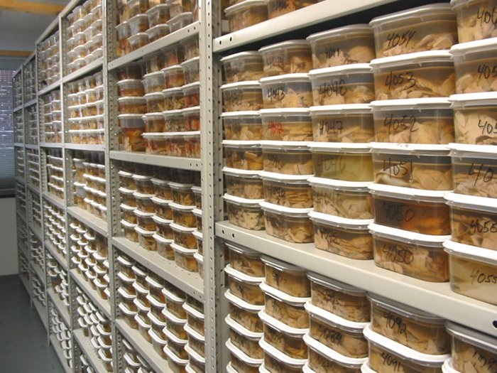 Welcome to the world`s largest brain bank 